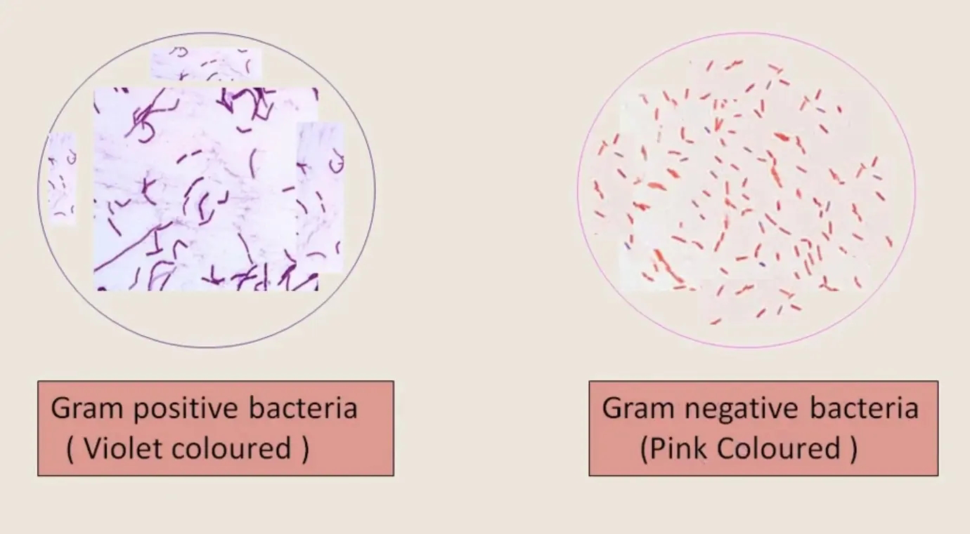 كت صبغة كرام Gram Staining Kit